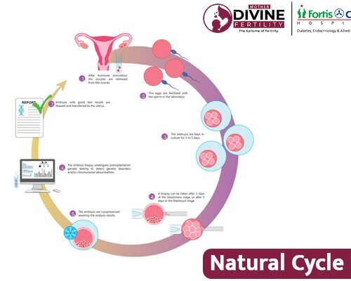 Natural Cycle IVF in Delhi