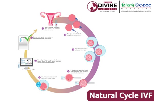 Natural Cycle IVF Delhi