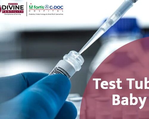 Best Test Tube Baby Centre in Delhi