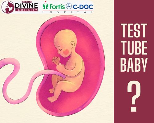 Test Tube Baby Means – Full Definition