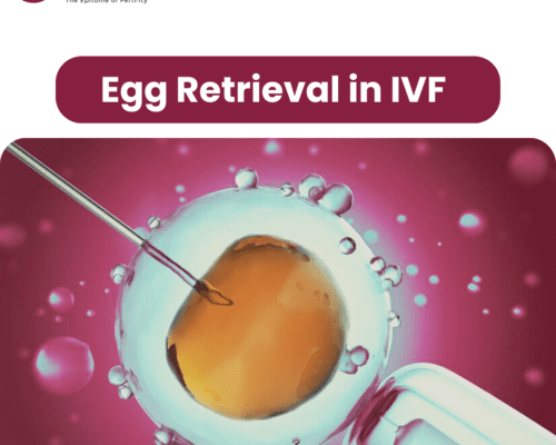 Understanding Egg Retrieval in IVF: Procedure, Risks, and Recovery