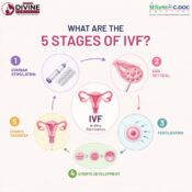 Infographic explaining the 5 stages of IVF treatment including ovarian stimulation, egg retrieval, fertilization, embryo development, and embryo transfer with medical illustrations on a clean white background.