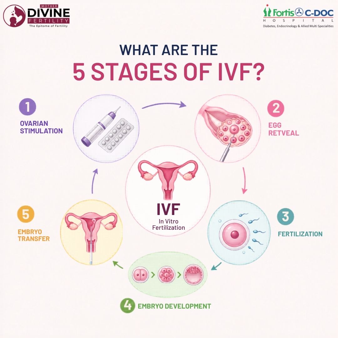 What Are the 5 Stages of IVF? A Complete IVF Procedure Guide for Couples