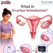 What is Ovarian Stimulation?