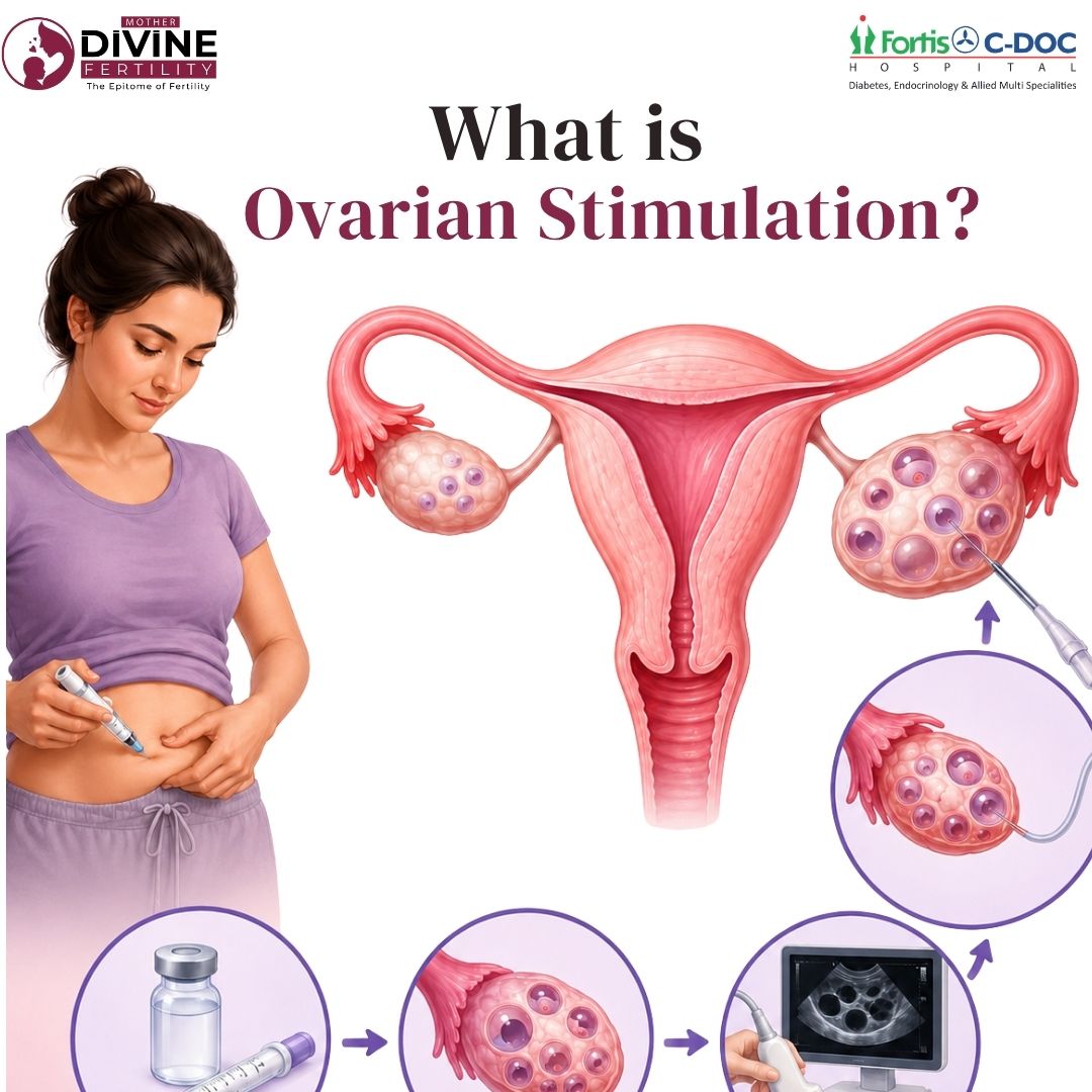 What is Ovarian Stimulation? A Complete Guide to IVF Ovarian Stimulation