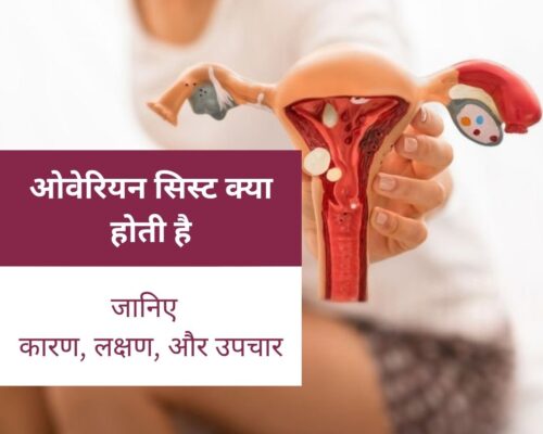 ओवेरियन सिस्ट क्या होती है: जानिए कारण, लक्षण, और उपचार